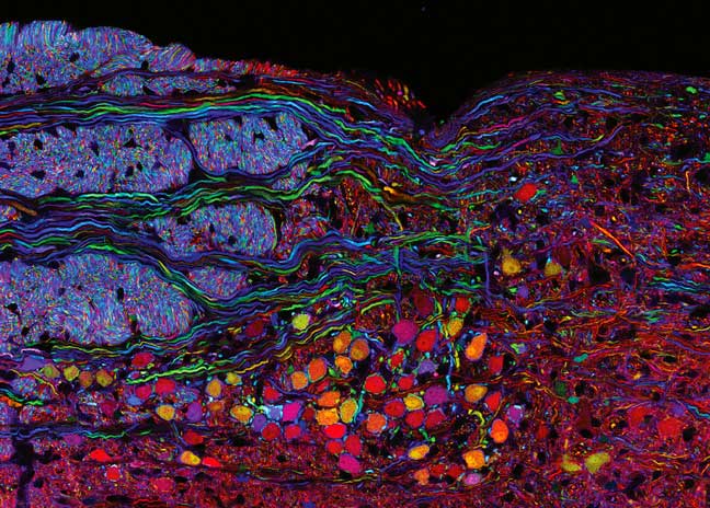Tronc cérébral d’une souris brainbow © Inserm